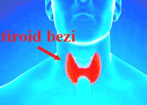 Tiroid Kanseri Tedavisi ve Akıllı İlaçlar 2023